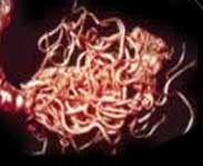 Roundworms