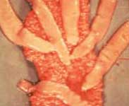 Tapeworms